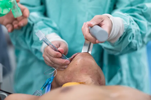 invoeging endotracheale buis