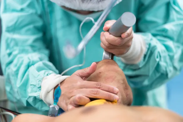 invoeging endotracheale buis