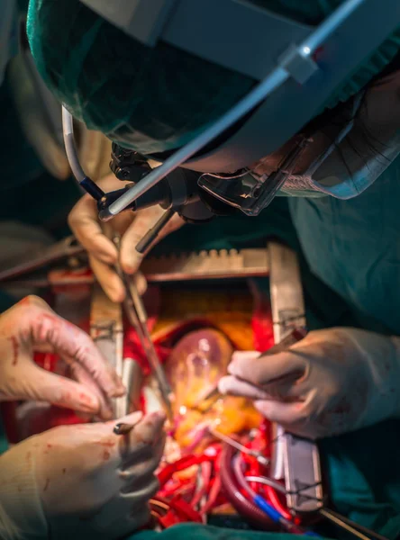 Cardiac surgeon — Stock Photo, Image