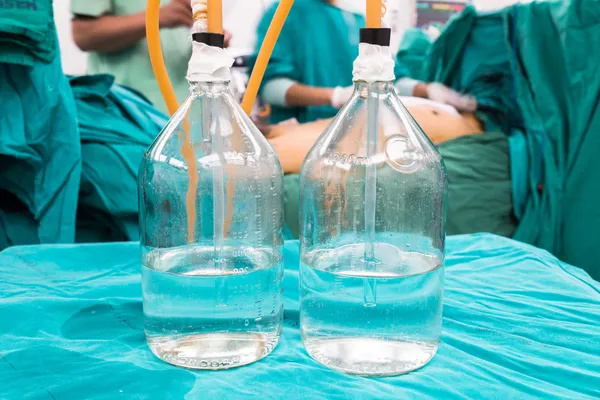 Zwei-Flaschen-System Intercostal Entwässerung — Stockfoto