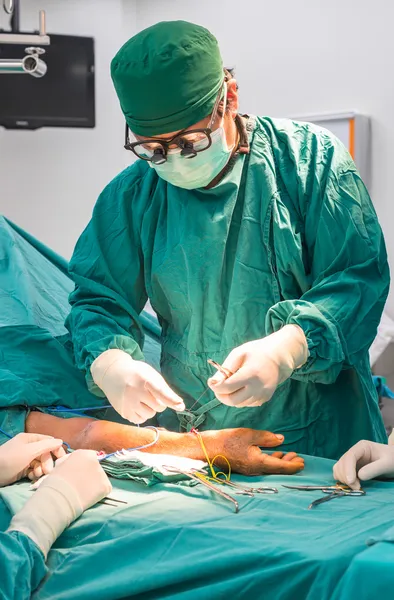 Surgeon operating arteriovenous fistula for long term dialysis for end stage renal disease patient — Stock Photo, Image