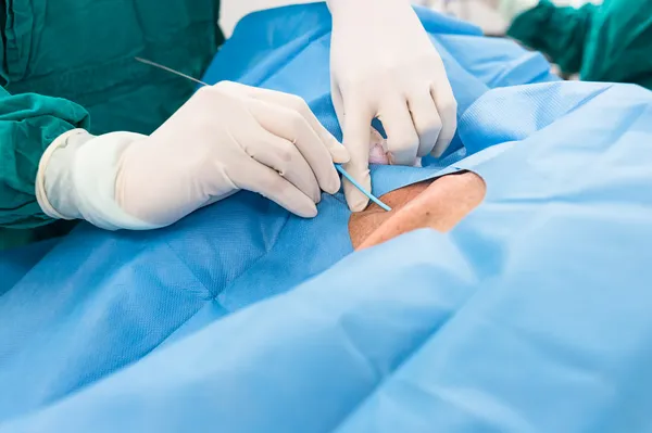 Merkezi Venöz basınç prosedürü