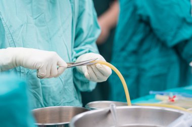 scrub hemşire göğüs drenaj açık kalp cerrahisi için hazırlanıyor