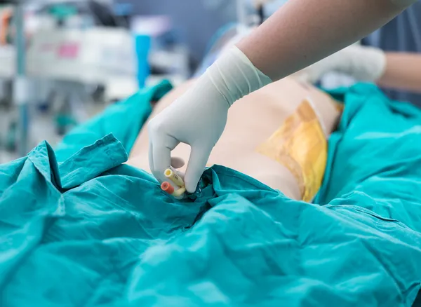 foley katheter behouden