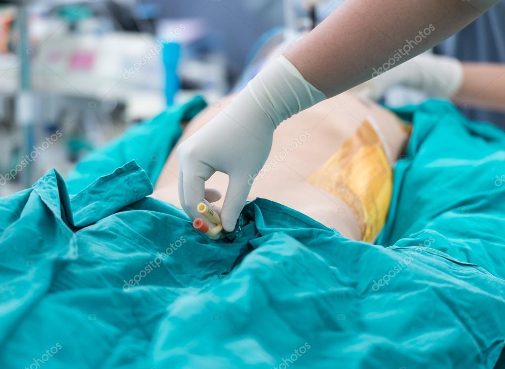 Photo foley catheter Retain foley catheter — Stock Photo © chanawit 51601081