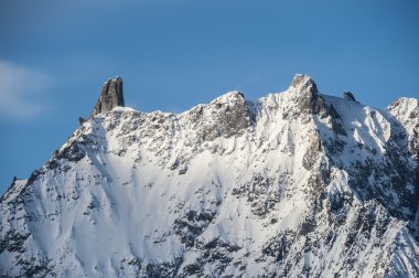 Dent du dev görünümü
