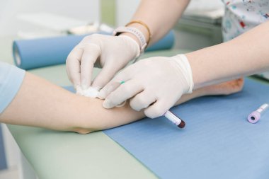 Tedavi odasındaki bir damardan kan testi alıyorum. Hemşire şırıngayı hastanın eline iğneyle batırıyor. Kan bağışı sırasında enjeksiyon yerine baskı yapılmış. Kanlı tüp