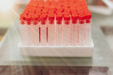 Tıp ve biyoteknoloji kimya araştırmaları laboratuarında tüp araştırmasında düşürücü