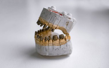 Diş hekimliği ve protez. Güzel dişlere ve sağlığa giden yol. İnsan ellerinde takma dişler.