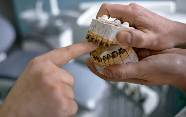 Odontología Prótesis Camino Los Dientes Hermosos Buena Salud Prótesis Manos — Foto de Stock