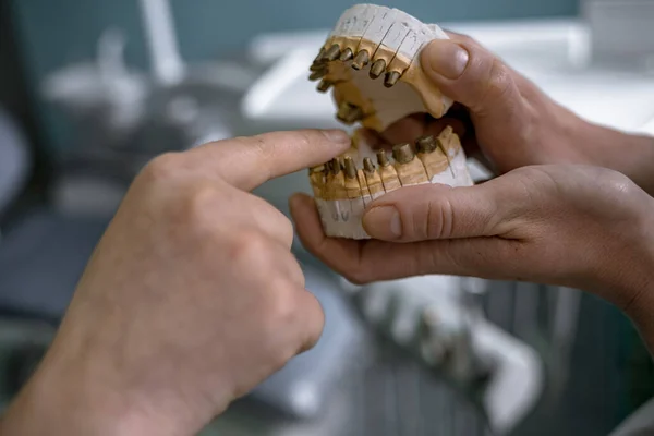 Odontología Prótesis Camino Los Dientes Hermosos Buena Salud Prótesis Manos — Foto de Stock