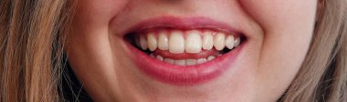 Kiev, Ukraine September 29, 2021: Beautiful smile with even teeth on the face of a young and beautiful girl