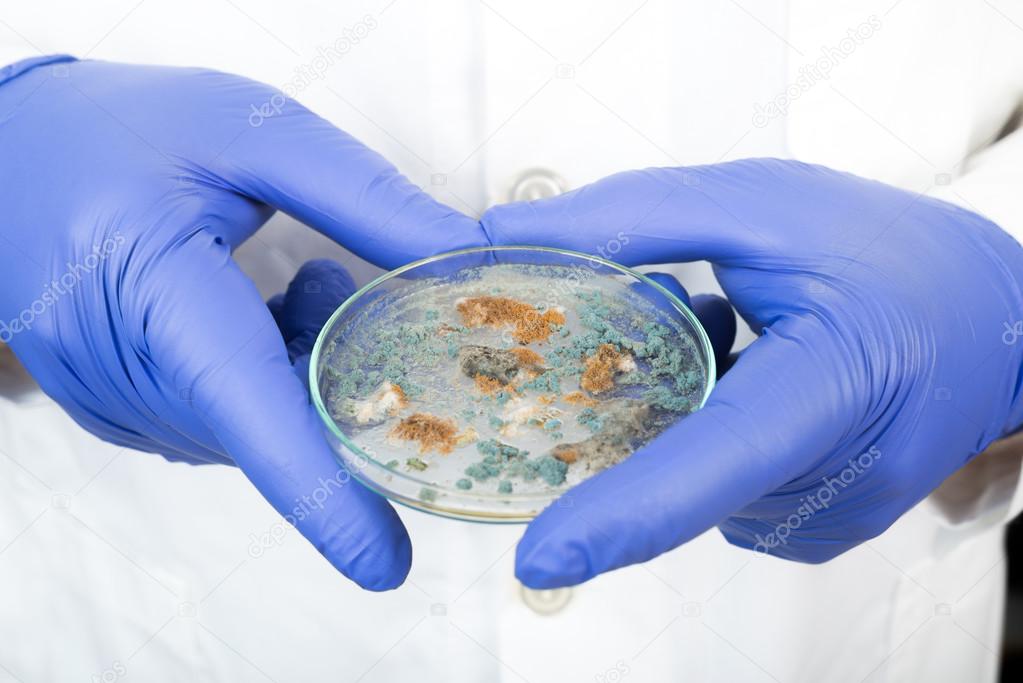 Petri dish with Penicillium fungi