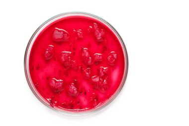 petri yemeklerinde büyüyen bakteriler