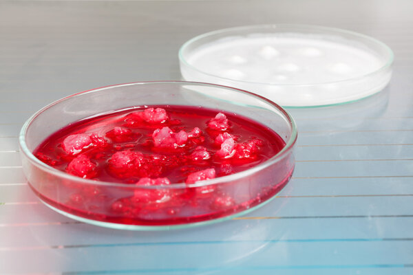 Growing Bacteria in Petri Dishes