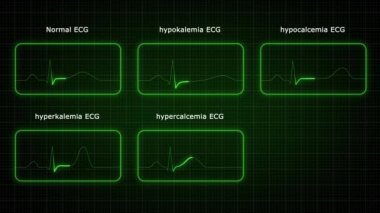 Yeşil ışık hayat çizgisi animasyonu parlıyor. Elektrikli neon ışıklandırma siyah arkaplanda çizgi animasyonunu takip ediyor. Kalp atış hızı elektrokardiyogramı. 3 Boyutlu Resimler