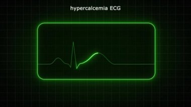 Yeşil ışık hayat çizgisi animasyonu parlıyor. Elektrikli neon ışıklandırma siyah arkaplanda çizgi animasyonunu takip ediyor. Kalp atış hızı elektrokardiyogramı. 3 Boyutlu Resimler