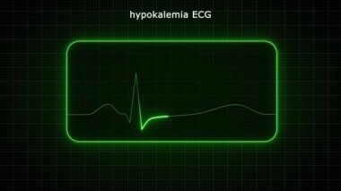 Yeşil ışık hayat çizgisi animasyonu parlıyor. Elektrikli neon ışıklandırma siyah arkaplanda çizgi animasyonunu takip ediyor. Kalp atış hızı elektrokardiyogramı. 3 Boyutlu Resimler