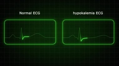Yeşil ışık hayat çizgisi animasyonu parlıyor. Elektrikli neon ışıklandırma siyah arkaplanda çizgi animasyonunu takip ediyor. Kalp atış hızı elektrokardiyogramı. 3 Boyutlu Resimler