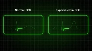 Yeşil ışık hayat çizgisi animasyonu parlıyor. Elektrikli neon ışıklandırma siyah arkaplanda çizgi animasyonunu takip ediyor. Kalp atış hızı elektrokardiyogramı. 3 Boyutlu Resimler
