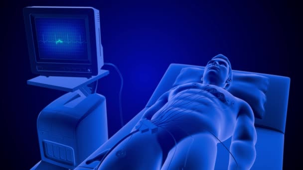 Ekg在床上与人一起监测脉搏时的心跳 3D渲染 — 图库视频影像