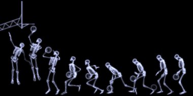 X-Ray rafiography of huan body (skeleton) playing basket ball clipart