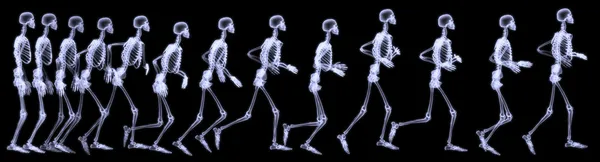 X-Ray radiography of human body (skeleton) — Stock Photo, Image