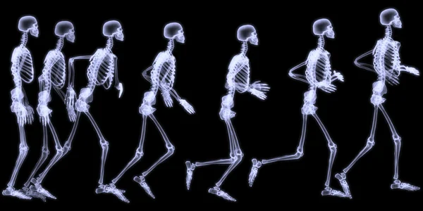 X-ray radiografie van menselijk lichaam (skelet) Rechtenvrije Stockfoto's