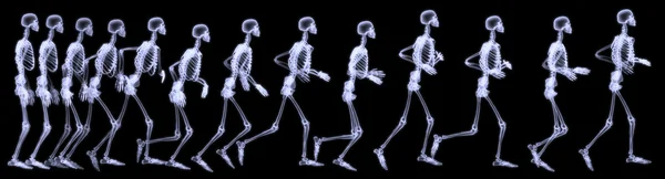 X-ray radiografie van menselijk lichaam (skelet) Stockafbeelding