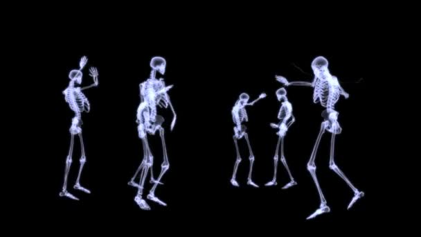 X-ray radiografie van menselijk lichaam (skelet) — Stockvideo