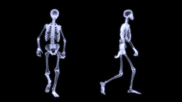 Radiografia de raios-X do corpo humano (esqueleto ) — Vídeo de Stock