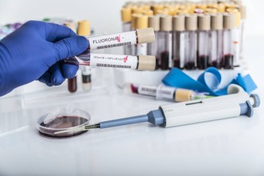 Doktorlar yeni Omicron varyasyonunun kan örneklerini ellerinde tutuyorlar. Ayrıca grip, kovid19, koronavirüs. Örnek tüpe seçici yaklaşım.