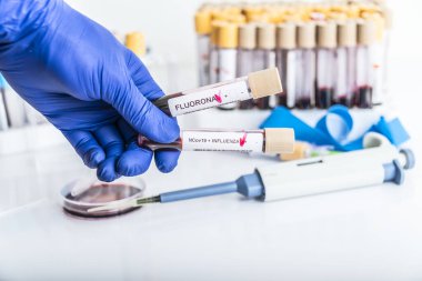 Doktorlar yeni Omicron varyasyonunun kan örneklerini ellerinde tutuyorlar. Ayrıca grip, kovid19, koronavirüs. Örnek tüpe seçici yaklaşım.