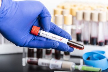 Doktorlar yeni IHU 'nun kan örneklerini ellerinde tutuyorlar, kovid19, koronavirüs. Örnek tüpe seçici yaklaşım.