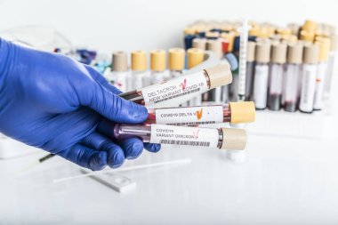 Covid-19 DELTACRON 'un yeni varyantından kan örneği ve covid-19 Coronavirus Mutasyonlarının genel verilerini içeren bir araştırmacı. Analiz laboratuarındaki doktor elinde yeni DELTACRON türü örnekleri tutuyor..