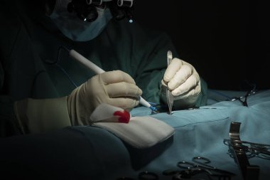 Kadın cerrah tek koluyla bir mikro cerrahi operasyonu gerçekleştiriyor.