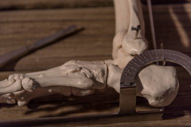 Klasik tıbbi çalışma masası. Travmatoloji ve ayak cerrahisi.