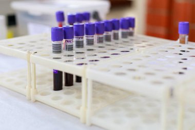 Kan için tıbbi test tüpleri. Kan bağışı günü için halka açık bir etkinlik. Metin veya harf için kopyalama alanı olan bir arkaplan. İllüstrasyon başyazısı. 13 Haziran 2021, Balti Moldova.