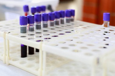 Kan için tıbbi test tüpleri. Kan bağışı günü için halka açık bir etkinlik. Metin veya harf için kopyalama alanı olan bir arkaplan. İllüstrasyon başyazısı. 13 Haziran 2021, Balti Moldova.