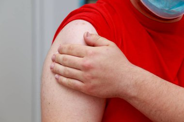 Hasta yamaya basarken elini enjeksiyon yerinde tutuyor. Covid-19 koronavirüse karşı gerçek aşı. Arkaplan