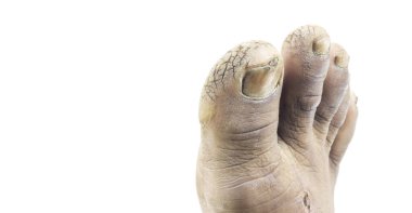 Beyaz arkaplanda izole edilmiş ayak parmağı