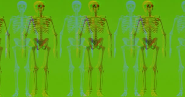 Überlagerung Des Alten Beschädigten Bildschirms Mit Rausch Und Störeffekt Mit — Stockvideo