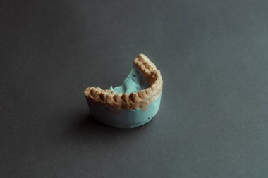 Diş protezi laboratuarı konsepti. 3 boyutlu modelleme için insan dişleri. Çene köprüsü 3D siyah arkaplan üzerindeki bir fotopolimer materyalden yazdırıldı.
