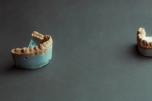 假牙实验室的概念 人类的假牙用于3D造型 用黑色背景的光聚合物材料打印的牙牙桥3D — 图库照片