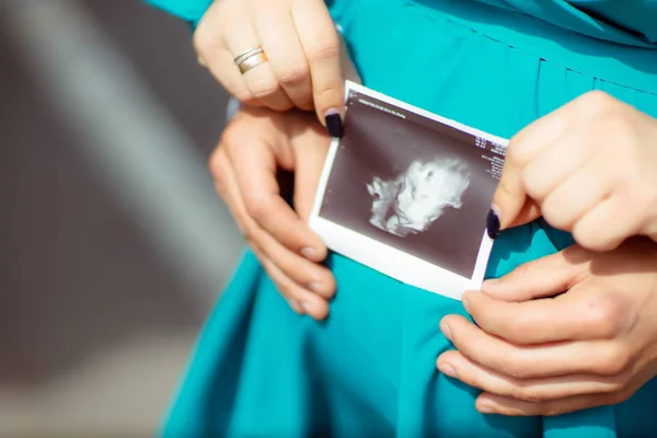 Pregnant Woman Man Holding Phot Embryo Photo — 图库照片