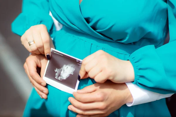 Pregnant Woman Man Holding Phot Embryo Photo — 图库照片