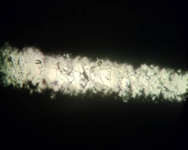 Mikroskop altında Aspergillus dezenfekte mantar miselyumu