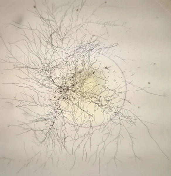 Fungal mycellium and bacterial colony under the microscope