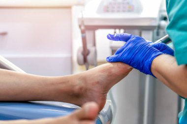 Ayak hastalıkları tedavisine yakın çekim. Seçici odak