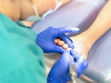 Ayak hastalıkları kliniğinde ayak masajı yapan bir kadın ayak hastalıkları uzmanı. Seçici odak